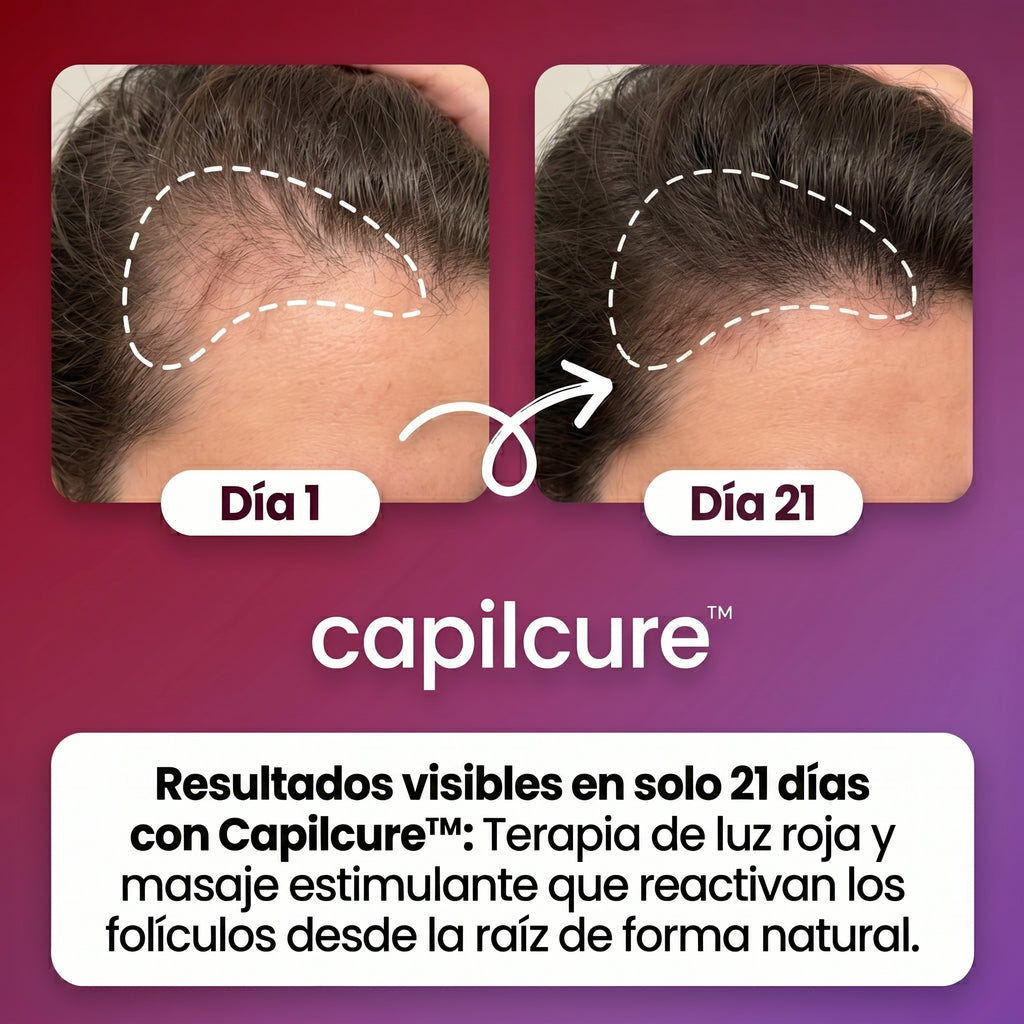 Capilcure™ DensiPulse