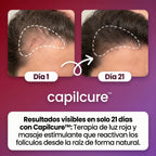 Capilcure™ DensiPulse